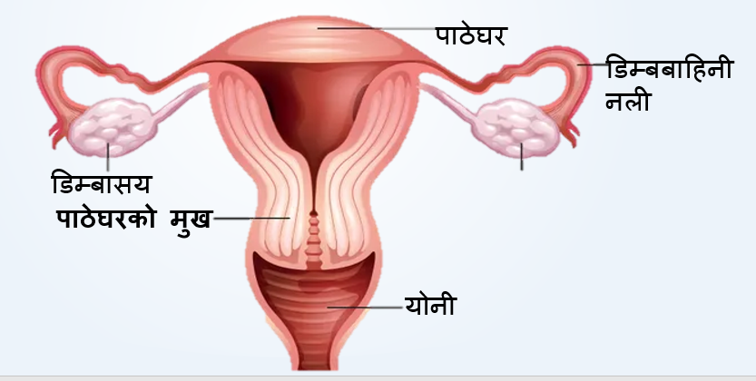 Cervical Cancer in Butwal